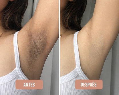 Crema Blanqueadora Para Axilas